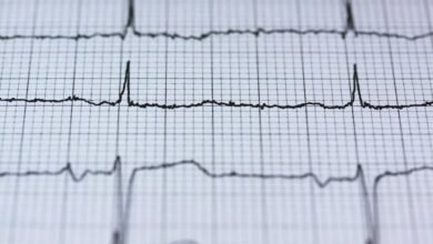 fusion pulse revenue node